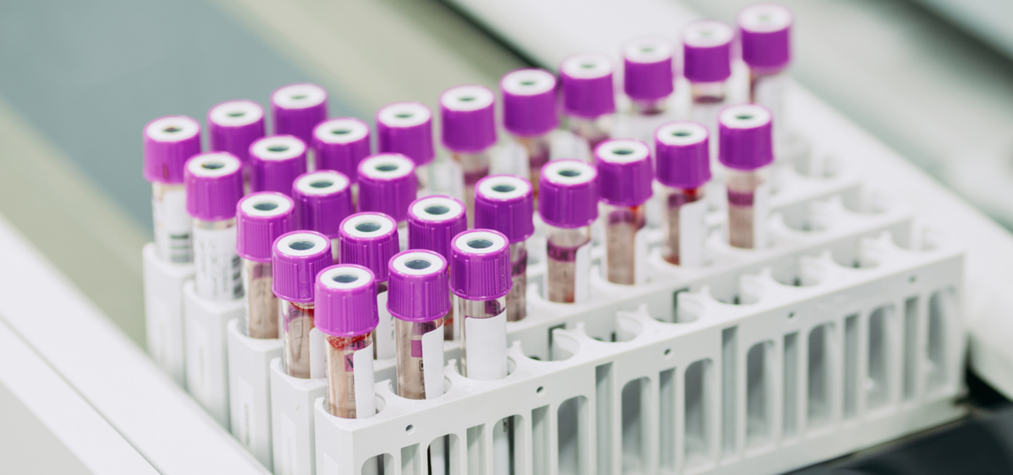 Specimen Reception & Pre-Analytical Processing